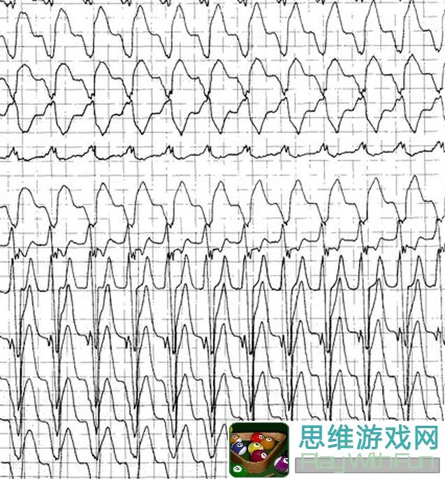 心动小镇最新版：捉虫爱好全揭秘，助你成为小镇捉虫高手！